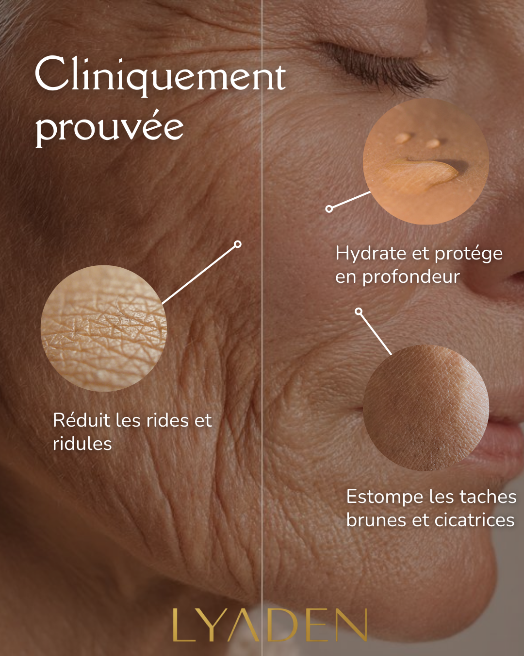 Image personnalisée